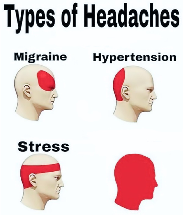 Types of Headaches meme about school